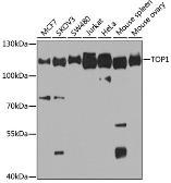 Anti-Topoisomerase I antibody used in Western Blot (WB). GTX64445