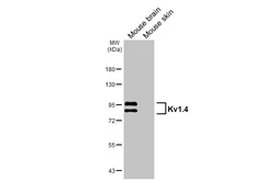 Anti-Kv1.4 antibody [GT240] used in Western Blot (WB). GTX644459