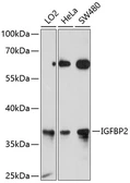 Anti-IGFBP2 antibody used in Western Blot (WB). GTX64446