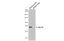 Anti-Kv1.5 antibody [GT241] used in Western Blot (WB). GTX644460