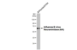 Anti-Influenza B virus Neuraminidase (NA) antibody [HL4607] used in Western Blot (WB). GTX644471