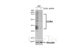 Anti-CCR4 antibody [HL4612] used in Western Blot (WB). GTX644476