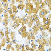 Anti-GABARAP antibody used in IHC (Paraffin sections) (IHC-P). GTX64449