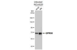 Anti-GPR50 antibody [HL4628] used in Western Blot (WB). GTX644492