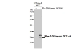 Anti-GPR148 antibody [HL4630] used in Western Blot (WB). GTX644494