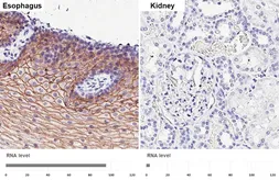 Anti-Desmocollin 2 antibody [HL4634] used in IHC (Paraffin sections) (IHC-P). GTX644507