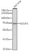 Anti-GOLPH2 antibody used in Western Blot (WB). GTX64452