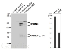 Anti-GPR125 antibody [HL4659] used in Western Blot (WB). GTX644532
