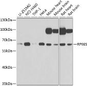 Anti-RPE65 antibody used in Western Blot (WB). GTX64456