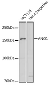 Anti-TMEM16A antibody used in Western Blot (WB). GTX64457