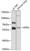 Anti-NPR-C antibody used in Western Blot (WB). GTX64458