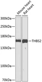 Anti-Thrombospondin 2 antibody used in Western Blot (WB). GTX64459