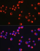 Anti-Peripherin antibody used in Immunocytochemistry/ Immunofluorescence (ICC/IF). GTX64462