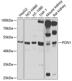 Anti-PON1 antibody used in Western Blot (WB). GTX64465