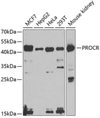 Anti-EPCR antibody used in Western Blot (WB). GTX64467