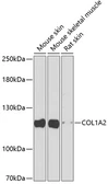 Anti-COL1A2 antibody used in Western Blot (WB). GTX64468