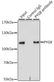 Anti-GPBB antibody used in Immunoprecipitation (IP). GTX64469