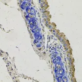 Anti-GAS6 antibody used in IHC (Paraffin sections) (IHC-P). GTX64470