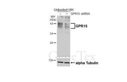 Anti-GPR15 antibody [HL4704] used in Western Blot (WB). GTX644705