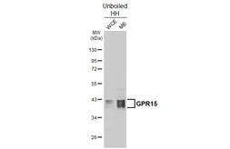 Anti-GPR15 antibody [HL4705] used in Western Blot (WB). GTX644706