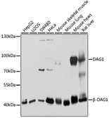 Anti-DAG1 antibody used in Western Blot (WB). GTX64471