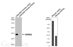 Anti-GPR23 antibody [HL4712] used in Western Blot (WB). GTX644713