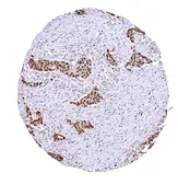 Anti-PCNA antibody [HMV4714] HistoMAX&trade; used in IHC (Paraffin sections) (IHC-P). GTX644715