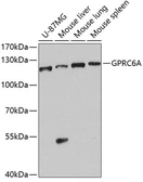 Anti-GPRC6A antibody used in Western Blot (WB). GTX64475