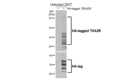 Anti-TXA2R antibody [HL4757] used in Western Blot (WB). GTX644761