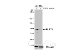 Anti-FLRT2 antibody [HL4784] used in Western Blot (WB). GTX644796