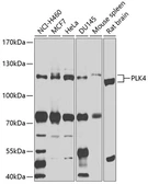 Anti-PLK4 antibody used in Western Blot (WB). GTX64480