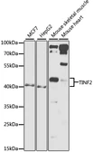 Anti-TIN2 antibody used in Western Blot (WB). GTX64484
