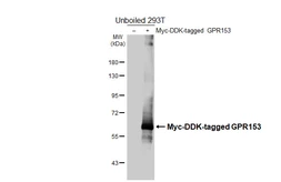 Anti-GPR153 antibody [HL4829] used in Western Blot (WB). GTX644841
