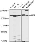 Anti-Hexokinase III antibody used in Western Blot (WB). GTX64487