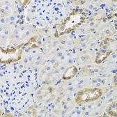 Anti-Hexokinase III antibody used in IHC (Paraffin sections) (IHC-P). GTX64487