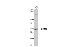Anti-STIM1 antibody [HL4832] used in Western Blot (WB). GTX644895