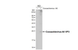Anti-Coxsackievirus A6 VP3 antibody [HL4839] used in Western Blot (WB). GTX644902