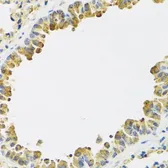 Anti-HRG antibody used in IHC (Paraffin sections) (IHC-P). GTX64492