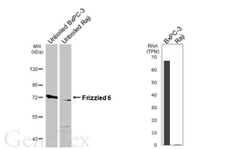 Anti-Frizzled 6 antibody [HL4857] used in Western Blot (WB). GTX644920