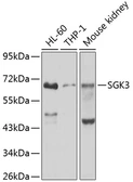 Anti-SGK3 antibody used in Western Blot (WB). GTX64494