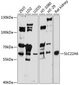 Anti-SLC22A6 antibody used in Western Blot (WB). GTX64500