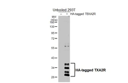 Anti-TXA2R antibody [HL4934] used in Western Blot (WB). GTX645007