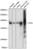 Anti-CPS1 antibody used in Western Blot (WB). GTX64501