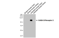 Anti-GABA B Receptor 2 antibody [HL4937] used in Western Blot (WB). GTX645010