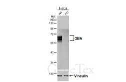 Anti-GBA antibody [HL4952] used in Western Blot (WB). GTX645038