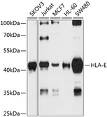 Anti-HLA-E antibody used in Western Blot (WB). GTX64504