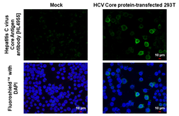 Anti-Hepatitis C virus Core Antigen antibody [HL4955] used in Immunocytochemistry/ Immunofluorescence (ICC/IF). GTX645041
