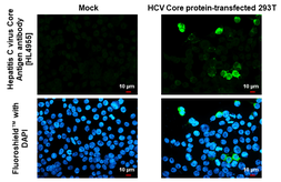 Anti-Hepatitis C virus Core Antigen antibody [HL4955] used in Immunocytochemistry/ Immunofluorescence (ICC/IF). GTX645041