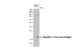 Anti-Hepatitis C virus Core Antigen antibody [HL4956] used in Western Blot (WB). GTX645042