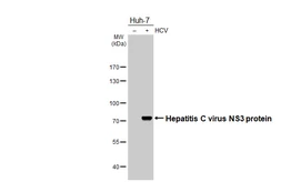 Anti-Hepatitis C virus NS3 protein antibody [HL4959] used in Western Blot (WB). GTX645045